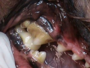 dental disease